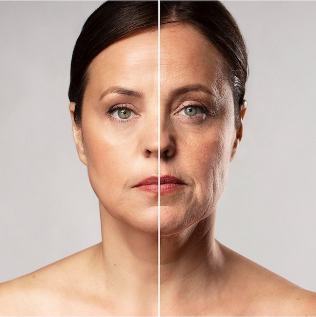 Suavização de expressões faciais e rugas - Aiko Odontoclinic