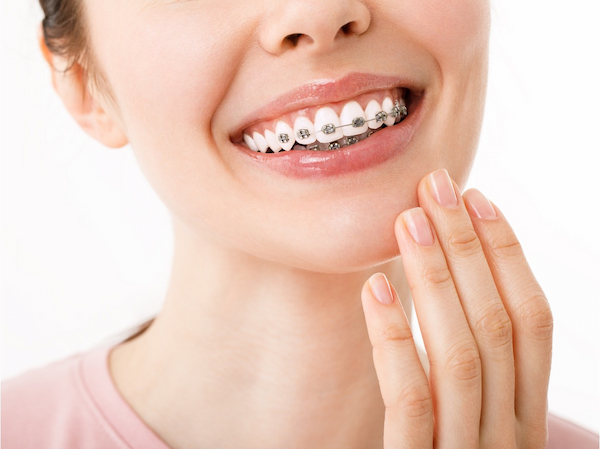 Ortodontia da Aiko Odontoclinic